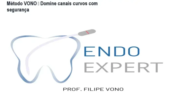 Kit físico de limas Vono e método de ampliação anatômica progressiva para endodontia complexa