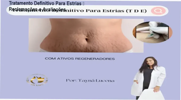 Tratamento Definitivo Para Estrias – Reclamações e Avaliações