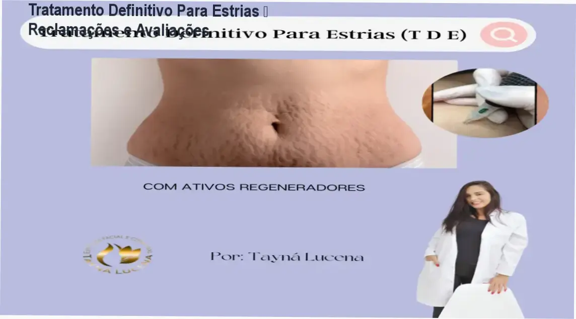 Tratamento Definitivo Para Estrias de Tayna de Lucena Silva – reclamações, avaliações e reputação