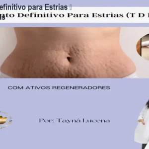Tratamento Definitivo para Estrias – Reduza Marcas