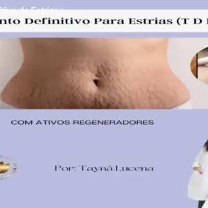 Tratamento Definitivo de Estrias – Curso Prático