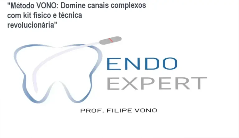 “Método VONO: Domine canais complexos com kit físico e técnica revolucionária”